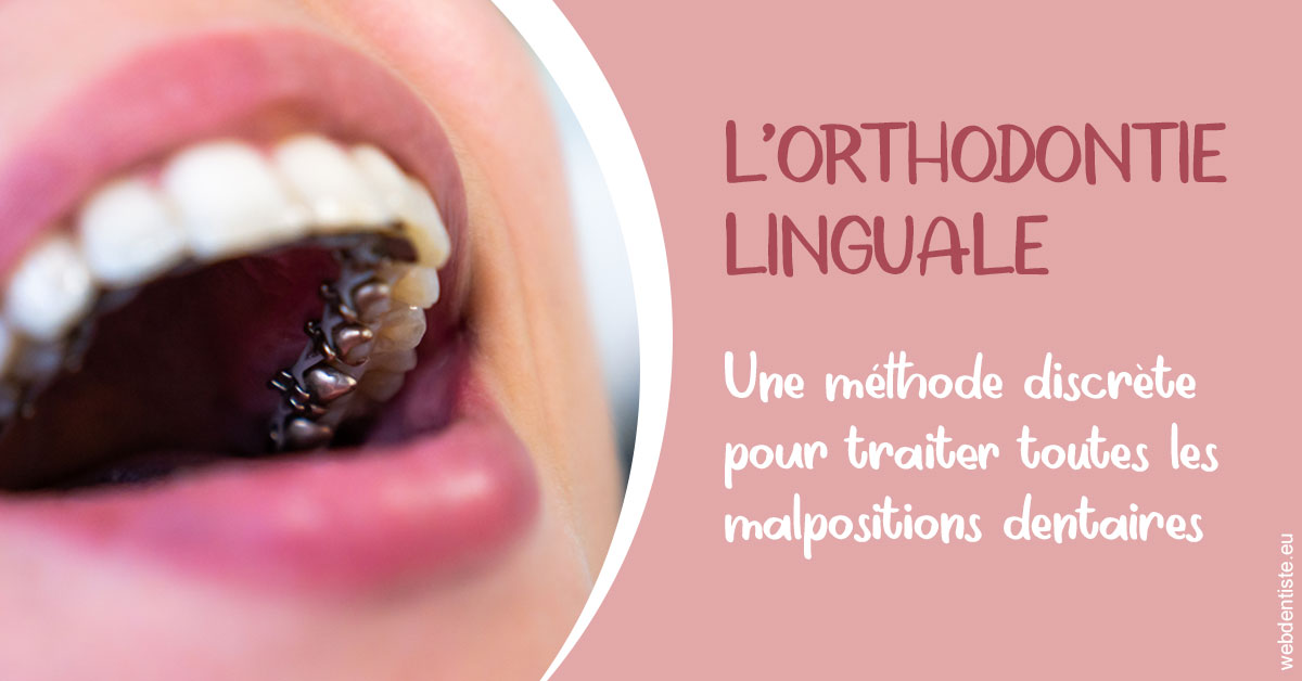https://www.centremedicodentairecannes.com/L'orthodontie linguale 2