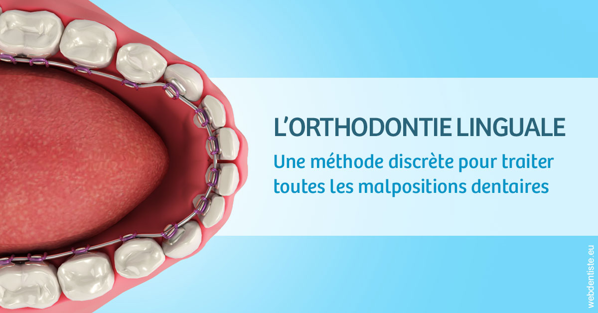 https://www.centremedicodentairecannes.com/L'orthodontie linguale 1