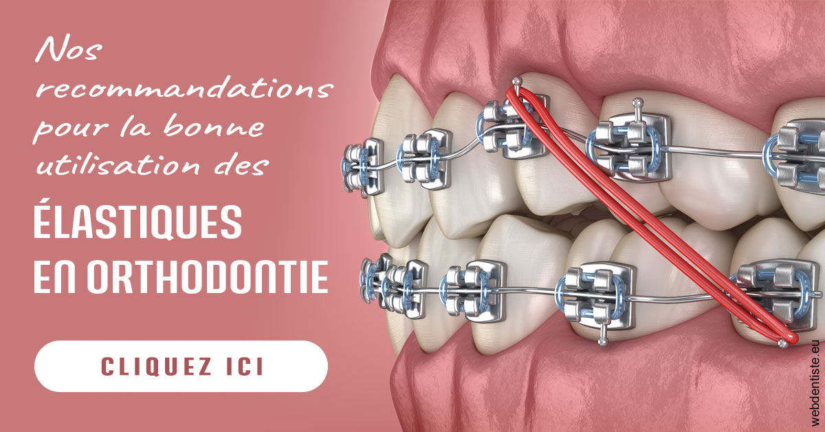 https://www.centremedicodentairecannes.com/Elastiques orthodontie 2